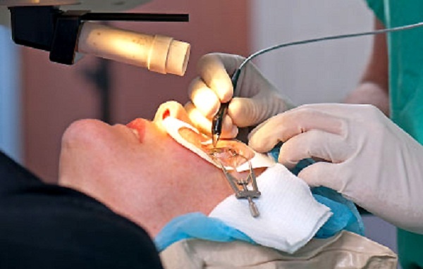 phẫu thuật khúcxaj